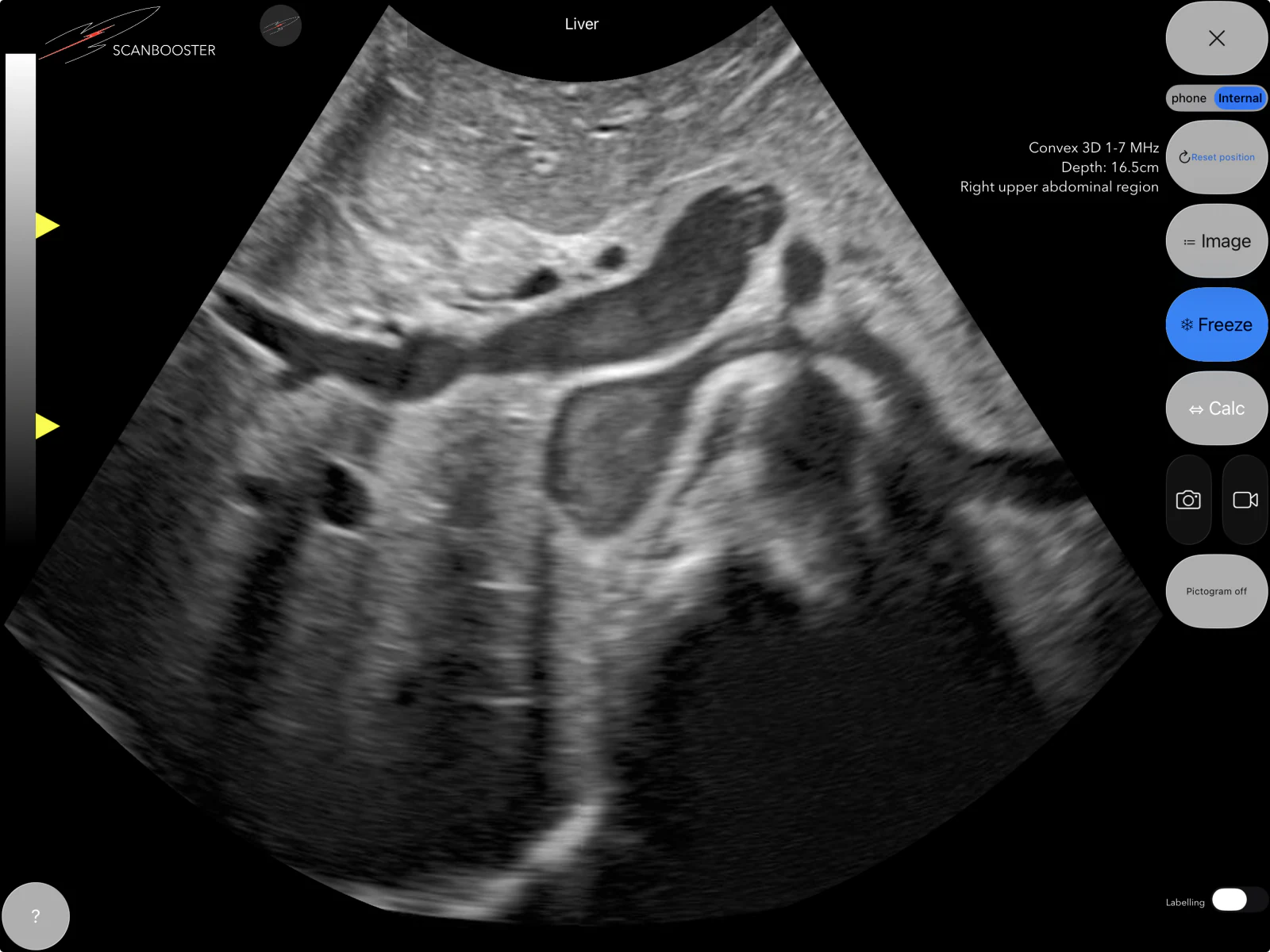 Ultrasound simulation