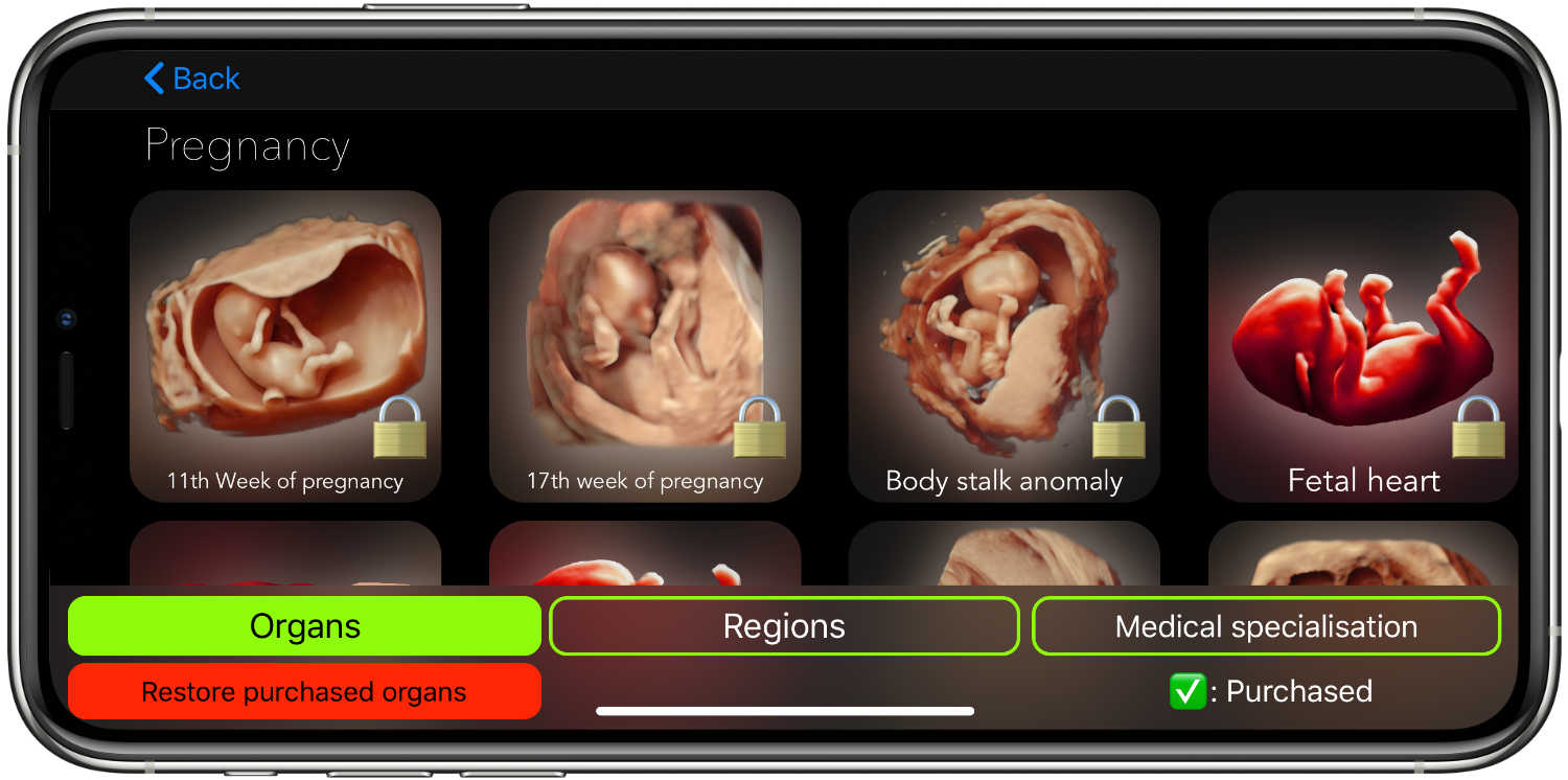 Realistic ultrasound and sonography simulation on iPhone - Scanbooster Ultrasound simulator app. Here are shown a large array of organs: e.g. liver ultrasound, pregnancy ultrasound - for you to learn sonography