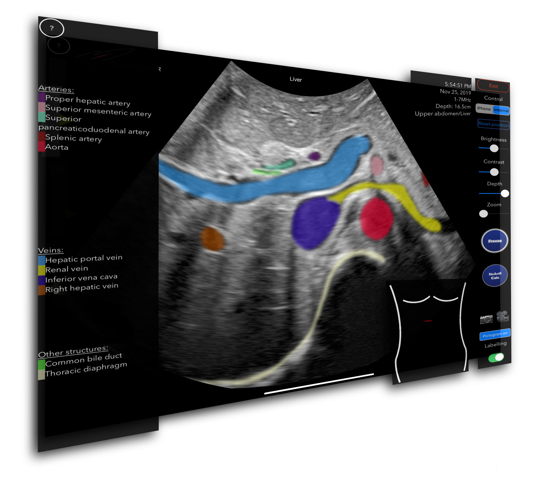 Realistic Ultrasound Simulator