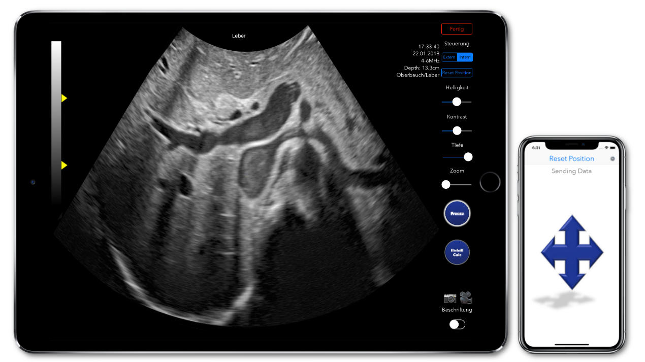 iPhone as a virtual ultrasound probe - ealisitic ultrasound simulation Scanbooster sonography