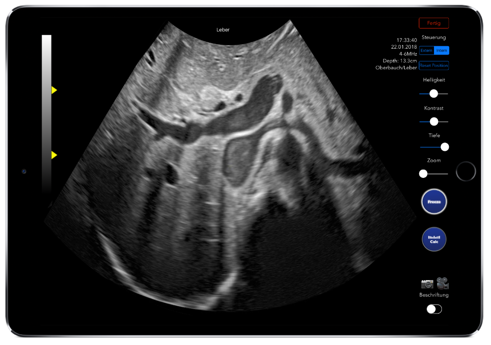 Simulate sonography remotely on an iPad tablet - learn kidney ultrasound focus, gyn, urology, obstetrics, internal medicine ultrasound