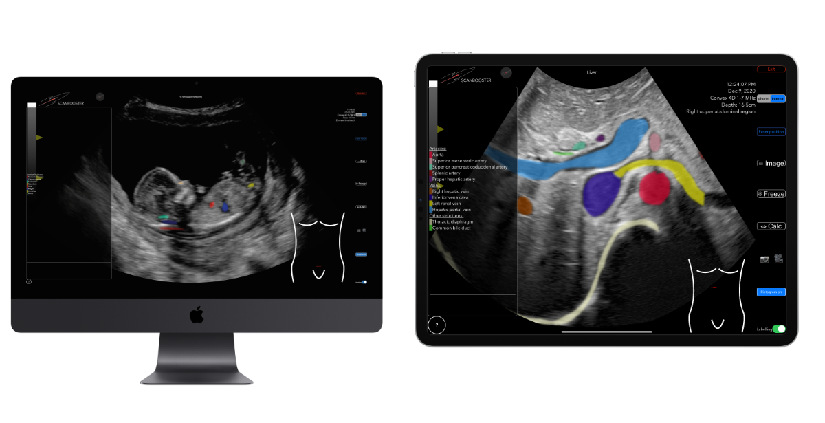 Scanbooster ultrasound simulator app online realistic ultrasound simulation - learn sonography in internal medicine and angiology online free download