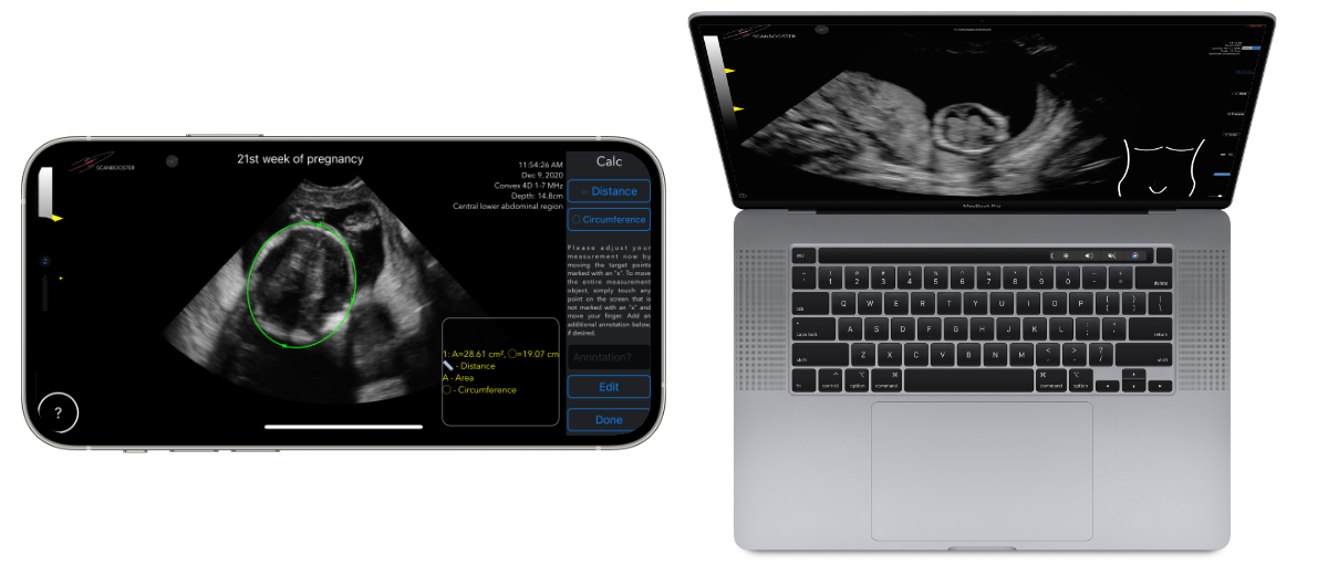 Scanbooster ultrasound simulator app - free online ultrasound simulator download online virtual scan gynecology and urology