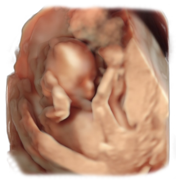 17th week of pregnancy physiological  sonographic ultrasound image simulation Scanbooster