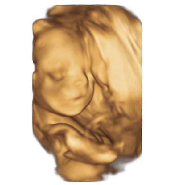 19th week of pregnancy physiological  sonographic ultrasound image simulation Scanbooster