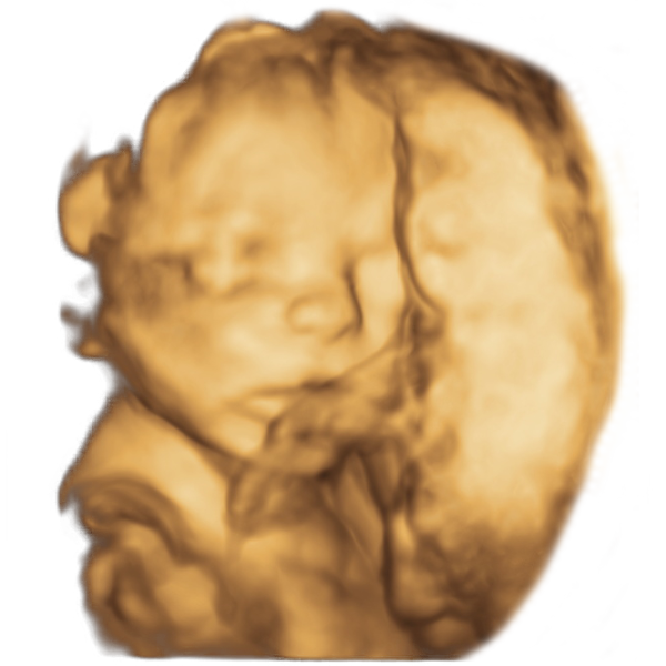 21st week of pregnancy physiological  sonographic ultrasound image simulation Scanbooster