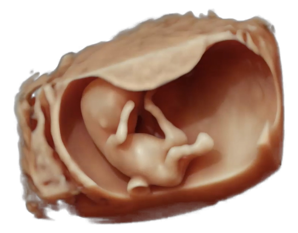 11th week of pregnancy physiological sonographic ultrasound image simulation Scanbooster