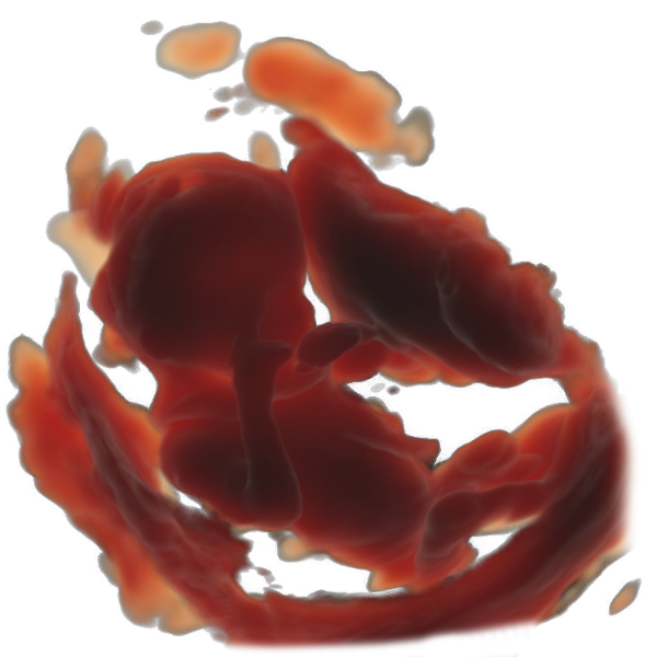 16th week of pregnancy physiological sonographic ultrasound image simulation Scanbooster