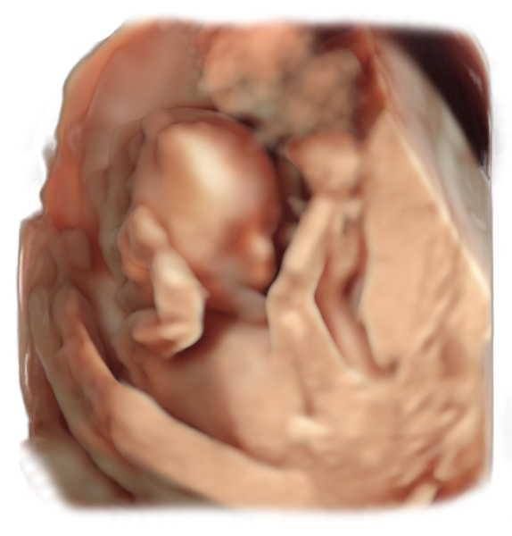 17th week of pregnancy physiological sonographic ultrasound image simulation Scanbooster