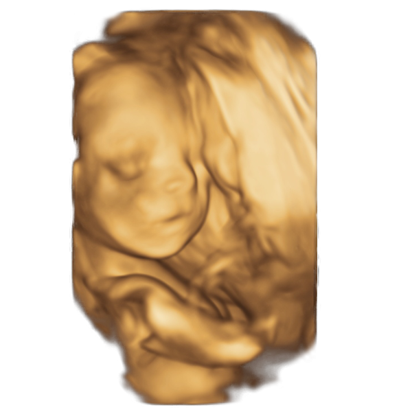 19th week of pregnancy physiological sonographic ultrasound image simulation Scanbooster
