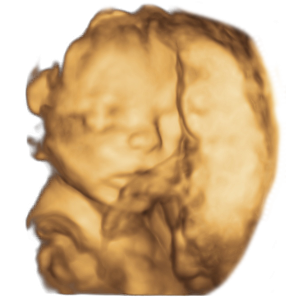 21st week of pregnancy physiological sonographic ultrasound image simulation Scanbooster