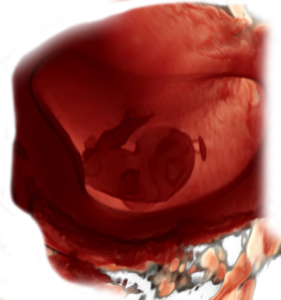 9th week of pregnancy physiological sonographic ultrasound image simulation Scanbooster