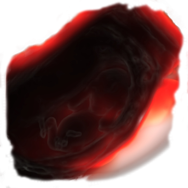 Fetal heart physiological sonographic ultrasound image simulation Scanbooster